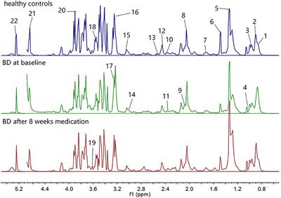 Pre- and Post-treatment Levels of Plasma Metabolites in Patients With Bipolar Depression